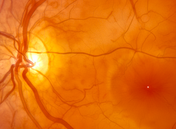 Macular health and central vision support